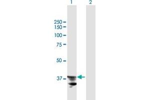 Western Blot analysis of ADAM22 expression in transfected 293T cell line by ADAM22 MaxPab polyclonal antibody. (ADAM22 Antikörper  (AA 1-342))