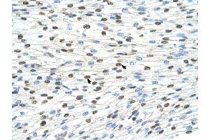 DAZAP1 antibody was used for immunohistochemistry at a concentration of 4-8 ug/ml to stain Myocardial cells (arrows) in Human Heart.