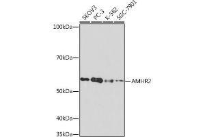 Western blot analysis of extracts of various cell lines, using  Rabbit mAb (ABIN7265630) at 1:1000 dilution. (AMHR2 Antikörper)