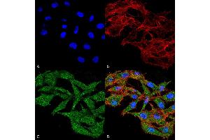 Immunofluorescence (fixed cells) (IF/ICC) image for anti-WD Repeat and FYVE Domain Containing 3 (WDFY3) (AA 533-544) antibody (Atto 594) (ABIN5066339)