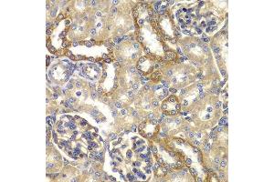 Immunohistochemistry of paraffin-embedded rat kidney using RAB5C antibody. (Rab5c Antikörper  (AA 1-216))