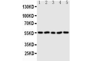 Anti-Syndecan 3 antibody, Western blotting Lane 1: U87 Cell Lysate Lane 2: 293T Cell Lysate Lane 3: PC-12 Cell Lysate Lane 4: NRK Cell Lysate Lane 5:  Cell Lysate (SDC3 Antikörper  (N-Term))