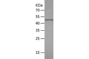 Western Blotting (WB) image for Programmed Cell Death 6 Interacting Protein (PDCD6IP) (AA 1-239) protein (His-IF2DI Tag) (ABIN7124578) (ALIX Protein (AA 1-239) (His-IF2DI Tag))