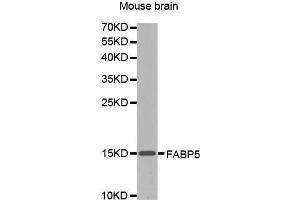 Western Blotting (WB) image for anti-Fatty Acid Binding Protein 5 (Psoriasis-Associated) (FABP5) (AA 1-100) antibody (ABIN1679794) (FABP5 Antikörper  (AA 1-100))
