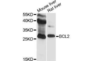 Western blot analysis of extracts of various cell lines, using BCL2 antibody. (Bcl-2 Antikörper)