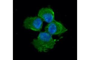ICC/IF analysis of MYL2 in A431 cells line, stained with DAPI (Blue) for nucleus staining and monoclonal anti-human MYL2 antibody (1:100) with goat anti-mouse IgG-Alexa fluor 488 conjugate (Green).