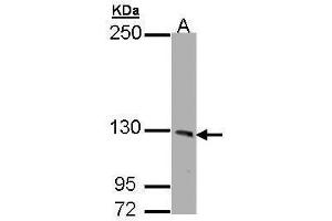 WB Image Sample (30 ug of whole cell lysate) A: HeLa 7. (PHKA1 Antikörper  (C-Term))