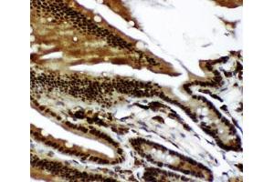 Immunohistochemistry (IHC) image for anti-Tumor Protein P73 (TP73) (AA 1-198) antibody (ABIN3029401)
