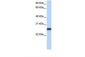 Image no. 1 for anti-Transmembrane Protease, serine 5 (TMPRSS5) (AA 270-319) antibody (ABIN6739260) (TMPRSS5 Antikörper  (AA 270-319))