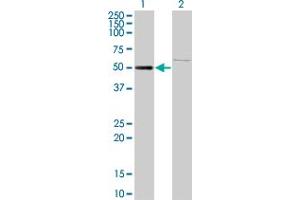 Western Blotting (WB) image for anti-Zinc Finger Protein 92 (ZNF92) (AA 490-587) antibody (ABIN599335) (ZNF92 Antikörper  (AA 490-587))