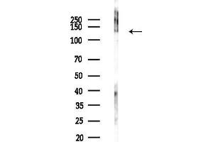 anti-Sin3A-Associated Protein, 130kDa (SAP130) (C-Term) antibody
