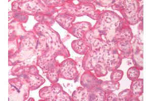 Human Placenta: Formalin-Fixed, Paraffin-Embedded (FFPE) (SLC5A6 Antikörper  (Internal Region))