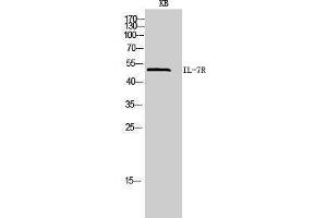 Western Blotting (WB) image for anti-Interleukin 7 Receptor (IL7R) (Internal Region) antibody (ABIN3181445)