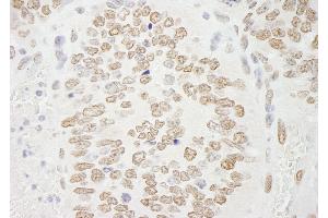 Immunohistochemistry (IHC) image for anti-Protein Arginine Methyltransferase 6 (PRMT6) (C-Term) antibody (ABIN7448744) (PRMT6 Antikörper  (C-Term))