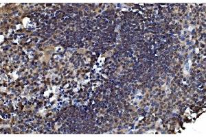 IHC analysis of OTULIN using anti-OTULIN antibody (ABIN7601854). (FAM105B Antikörper  (AA 49-352))