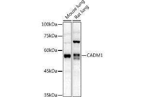 Western blot analysis of extracts of various cell lines, using C antibody (ABIN3022654, ABIN3022655, ABIN3022656 and ABIN6219028) at 1:1000 dilution. (CADM1 Antikörper  (AA 45-344))