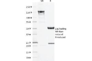 SDS-PAGE Analysis Purified CD10 Mouse Monoclonal Antibody (MME/1893).