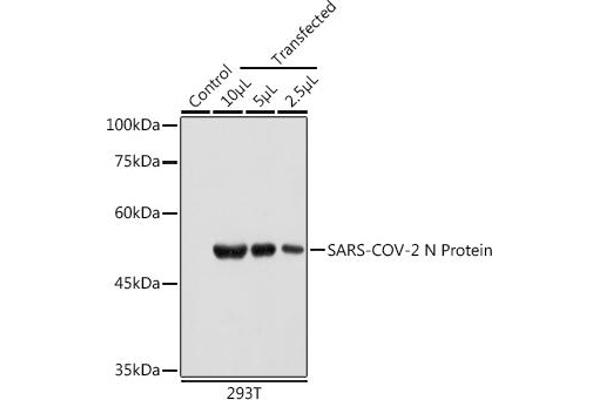 SARS-CoV-2 Nucleocapsid Antikörper