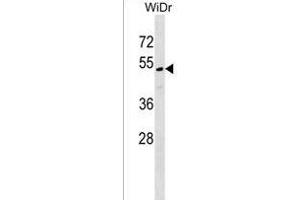 MLF1IP Antibody (C-term) (ABIN1537070 and ABIN2849045) western blot analysis in WiDr cell line lysates (35 μg/lane). (MLF1IP Antikörper  (C-Term))