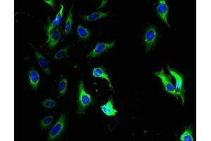 Immunofluorescent analysis of Hela cells using ABIN7154031 at dilution of 1:100 and Alexa Fluor 488-congugated AffiniPure Goat Anti-Rabbit IgG(H+L) (QPCTL Antikörper  (AA 212-382))