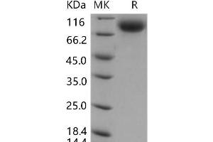 Western Blotting (WB) image for Selectin E (SELE) (Active) protein (His tag) (ABIN7197870)