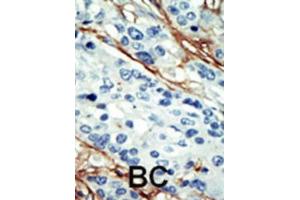 Immunohistochemistry (IHC) image for anti-NUAK Family, SNF1-Like Kinase, 1 (NUAK1) antibody (ABIN2908464) (NUAK1 Antikörper)