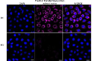 Immunocytochemical staining of HeLa cells using Electron transfer flavoprotein subunit alpha antibody (ABIN7798431), 1:1,000), Top panel: wild-type (WT), Bottom panal: Adiponectin receptor 1 shRNA knockdown (KD).