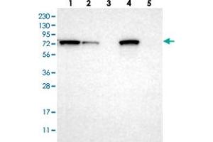 Western blot analysis of Lane 1: RT-4, Lane 2: U-251 MG, Lane 3: Human Plasma, Lane 4: Liver, Lane 5: Tonsil with HADHA polyclonal antibody  at 1:250-1:500 dilution.