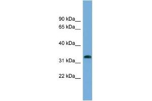 WB Suggested Anti-IFI35 Antibody Titration:  0. (IFI35 Antikörper  (N-Term))