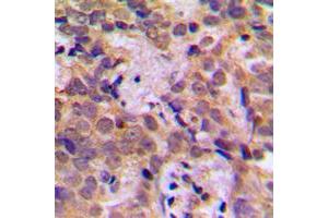 Immunohistochemistry (IHC) image for anti-Nuclear Factor of kappa Light Polypeptide Gene Enhancer in B-Cells 1 (NFKB1) (C-Term), (pSer932) antibody (ABIN7299380)