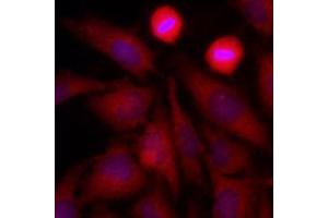 Immunofluorescence of human HeLa cells stained with Hoechst 3342 (Blue) for nucleus staining and monoclonal anti-human GAPDH antibody (1:500) with Texas Red (Red). (GAPDH Antikörper  (AA 1-335))