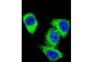 Confocal immunofluorescent analysis of TOP2A Antibody (C-term) with Hela cell followed by Alexa Fluor 488-conjugated goat anti-rabbit lgG (green). (Topoisomerase II alpha Antikörper  (C-Term))