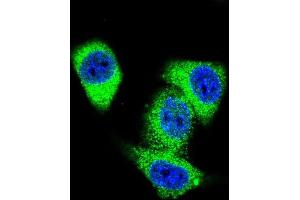Confocal immunofluorescent analysis of TOP2A Antibody (C-term) with Hela cell followed by Alexa Fluor 488-conjugated goat anti-rabbit lgG (green).