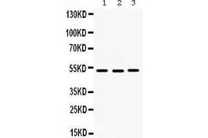 Western blot analysis of Cdc25C expression in HELA whole cell lysates (lane 1), SW620 whole cell lysates (lane 2) and MCF-7 whole cell lysates (lane 3). (CDC25C Antikörper  (C-Term))