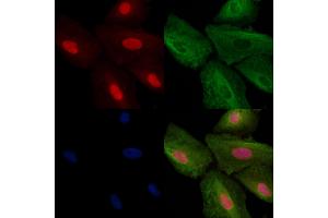 ABIN6257756 and ABIN6273652 staining  cells by IF/ICC. (IL16 Antikörper  (C-Term))