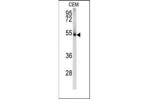 Image no. 1 for anti-Protein Kinase, CAMP-Dependent, Regulatory, Type I, alpha (Tissue Specific Extinguisher 1) (PRKAR1A) (N-Term) antibody (ABIN360569) (PRKAR1A Antikörper  (N-Term))