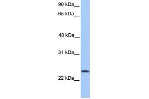WB Suggested Anti-RP11-269F19. (TCTEX1D4 Antikörper  (N-Term))