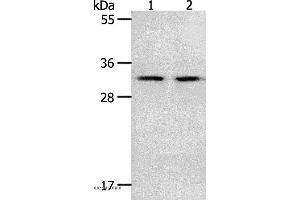 Western blot analysis of Mouse spleen and intestinum crassum tissue, using NME6 Polyclonal Antibody at dilution of 1:400 (NME6 Antikörper)