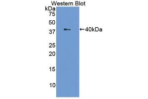 Detection of Recombinant LTF, Cattle using Polyclonal Antibody to Lactoferrin (LTF) (Lactoferrin Antikörper  (AA 25-352))