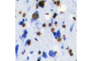 Immunohistochemistry (IHC) image for anti-Transketolase (TKT) antibody (ABIN7308412)