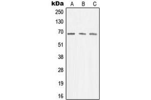 Western blot analysis of Menin expression in K562 (A), Jurkat (B), A431 (C) whole cell lysates. (Menin Antikörper  (Center))