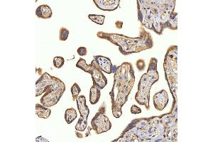 IHC analysis of SRPRA using anti-SRPRA antibody (ABIN7601408). (SRPRA (AA 346-638) Antikörper)
