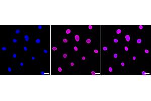 Immunocytochemical staining of C2C12 cells with E2F transcription factor 1 antibody (ABIN7798413), 1:1,000).