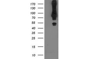 Western Blotting (WB) image for anti-Mahogunin, Ring Finger 1 (MGRN1) antibody (ABIN1499459) (Mahogunin RING Finger Protein 1 Antikörper)