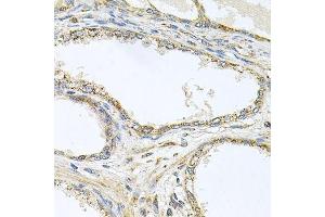 Immunohistochemistry of paraffin-embedded human prostate using TNFRSF10A antibody. (TNFRSF10A Antikörper  (AA 269-468))