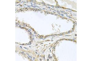 Immunohistochemistry (Paraffin-embedded Sections) (IHC (p)) image for anti-Tumor Necrosis Factor Receptor Superfamily, Member 10a (TNFRSF10A) (AA 269-468) antibody (ABIN6149302)