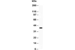 Western blot testing of SIRT3 antibody and recombinant human protein (0. (SIRT3 Antikörper  (AA 66-399))