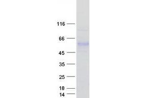 Western Blotting (WB) image for Interleukin 6 Receptor (IL6R) (Transcript Variant 2) protein (Myc-DYKDDDDK Tag) (ABIN2713399)