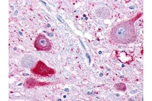 Immunohistochemical staining of Brain (Neurons) using anti- NPFFR1 antibody ABIN122333 (NPFFR1 Antikörper)