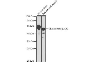 Western blot analysis of extracts of various cell lines, using Glucokinase (Glucokinase (GCK)) antibody (ABIN6131694, ABIN6141012, ABIN6141013 and ABIN6221893) at 1:1000 dilution. (GCK Antikörper  (AA 1-300))